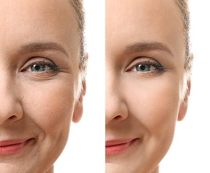 Eyecatcha Grace Anti-Aging