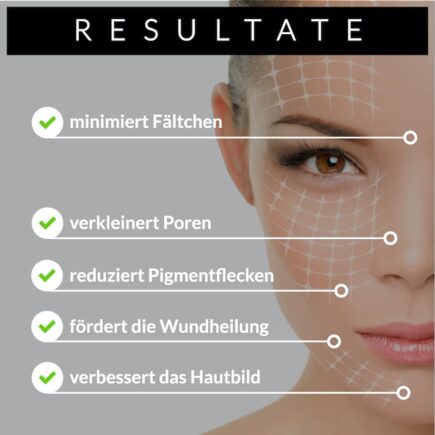 Dermaroller Resultate